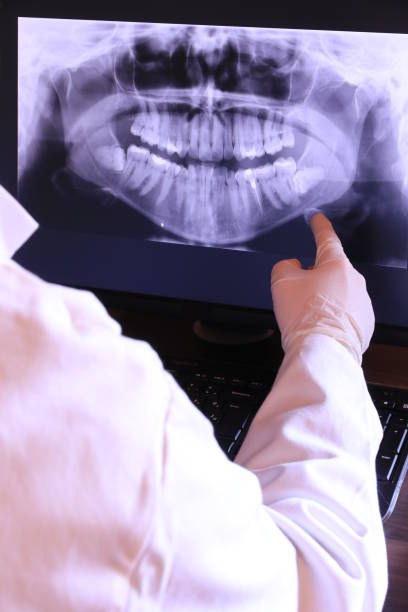 Best Emergency Dental Care for Abscessed Tooth in Bluff City, TN