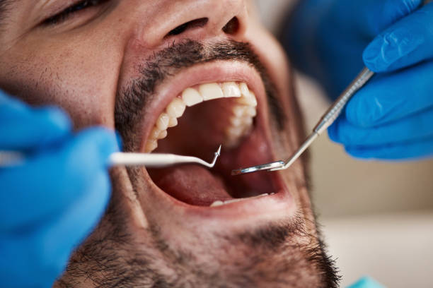 Best Mobile Emergency Dentist in Bluff City, TN