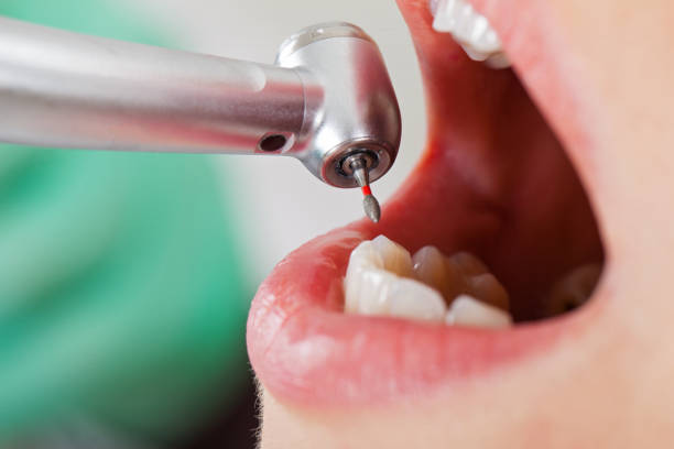 Best Emergency Dental Services for Seniors in Bluff City, TN